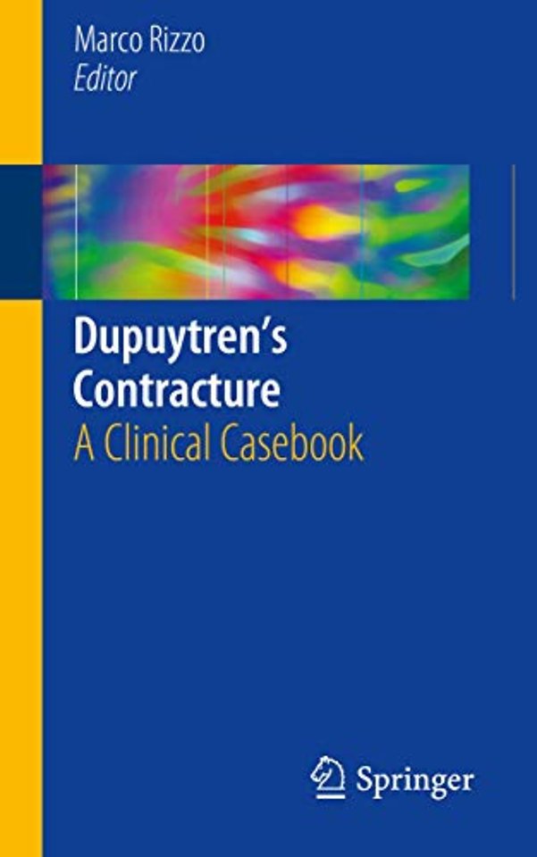 Dupuytren’s Contracture