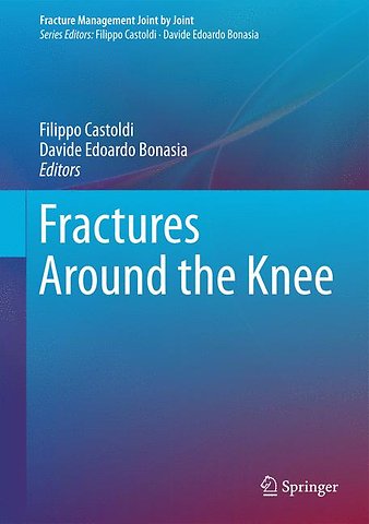 Fractures Around the Knee