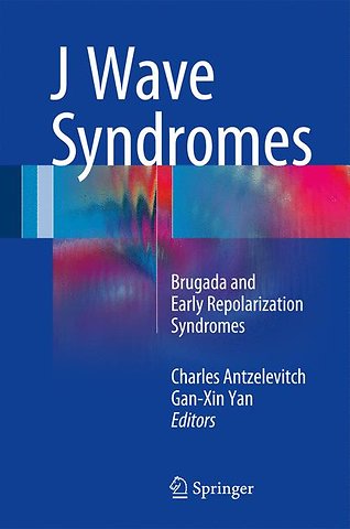 J Wave Syndromes