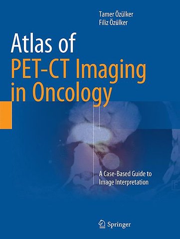 Atlas of PET-CT Imaging in Oncology