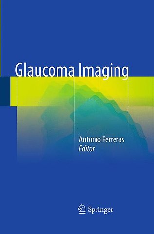 Glaucoma Imaging