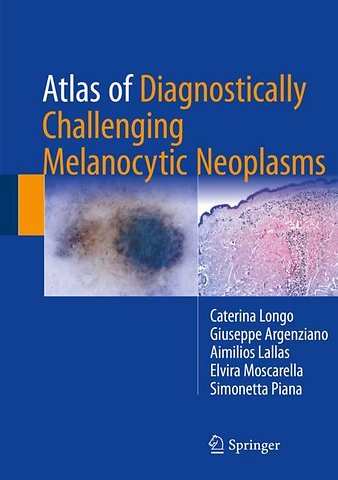 Atlas of Diagnostically Challenging Melanocytic Neoplasms