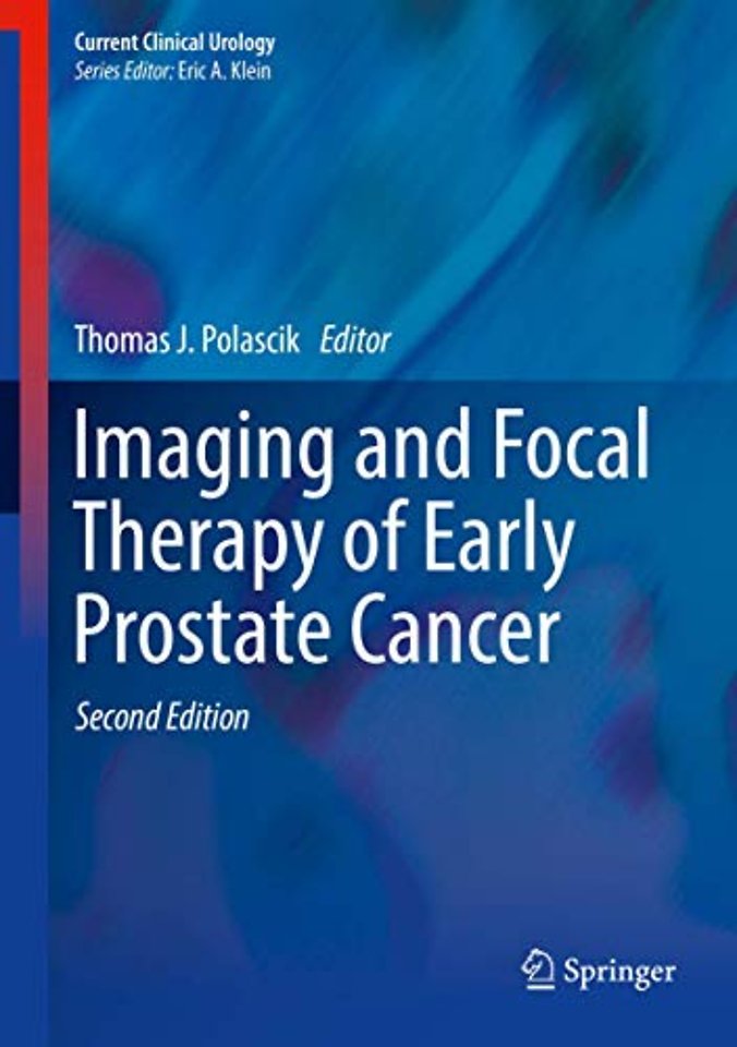Imaging and Focal Therapy of Early Prostate Cancer