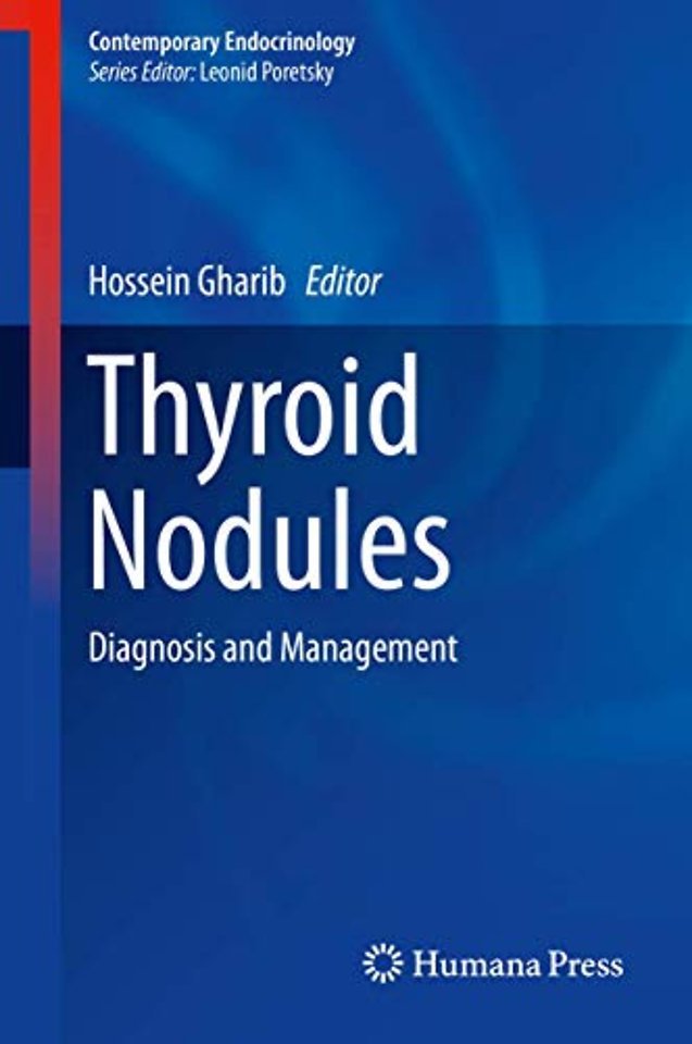 Thyroid Nodules