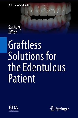 Graftless Solutions for the Edentulous Patient