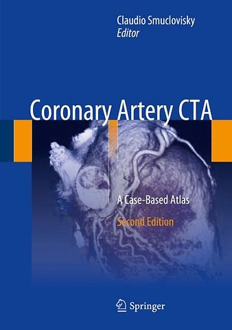 Coronary Artery CTA