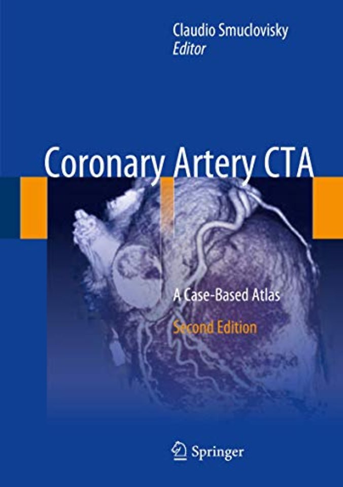Coronary Artery CTA