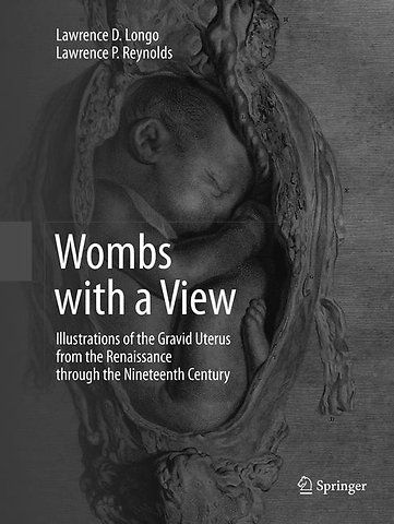 Wombs with a View