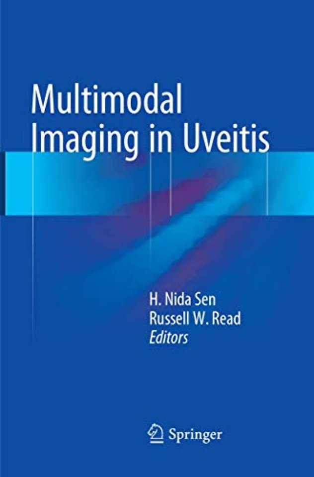 Multimodal Imaging in Uveitis