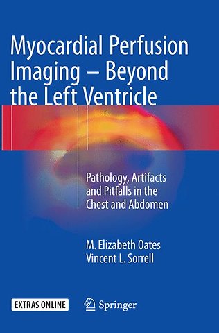 Myocardial Perfusion Imaging - Beyond the Left Ventricle