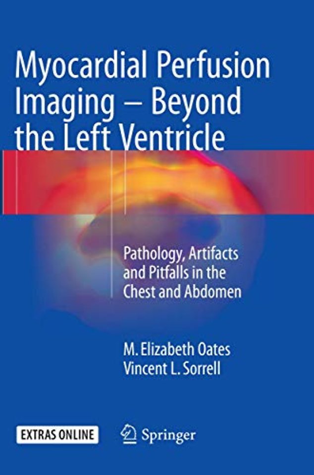 Myocardial Perfusion Imaging - Beyond the Left Ventricle