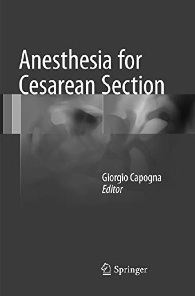 Anesthesia for Cesarean Section