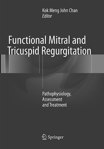 Functional Mitral and Tricuspid Regurgitation