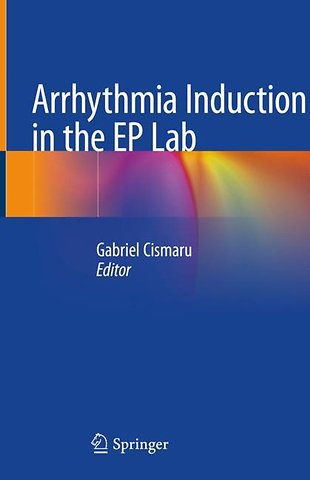 Arrhythmia Induction in the EP Lab