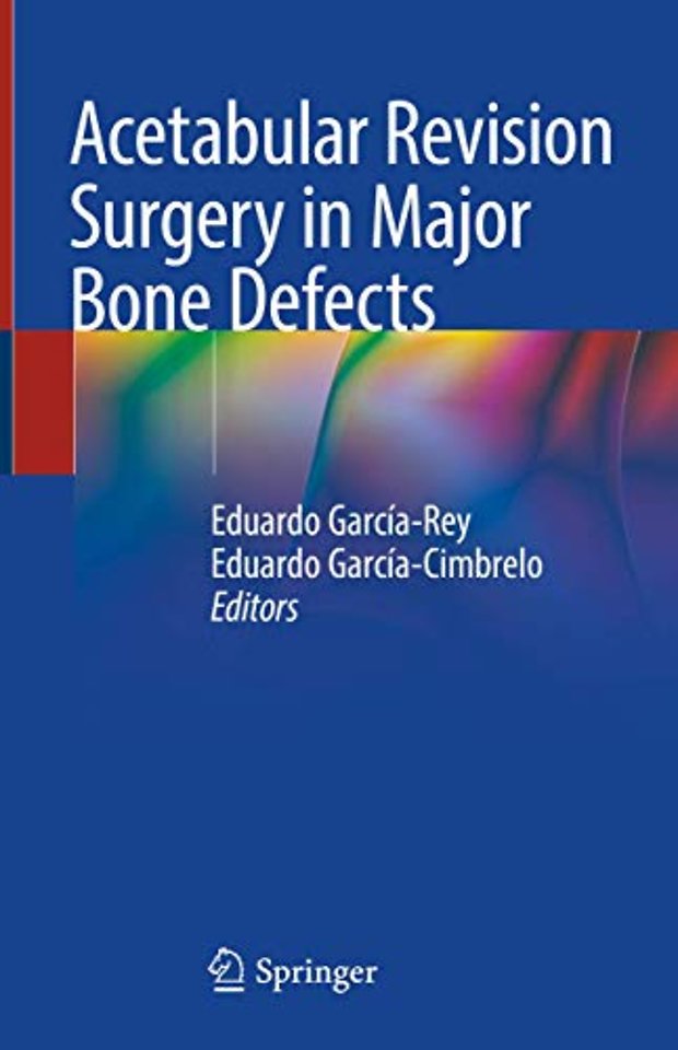 Acetabular Revision Surgery in Major Bone Defects