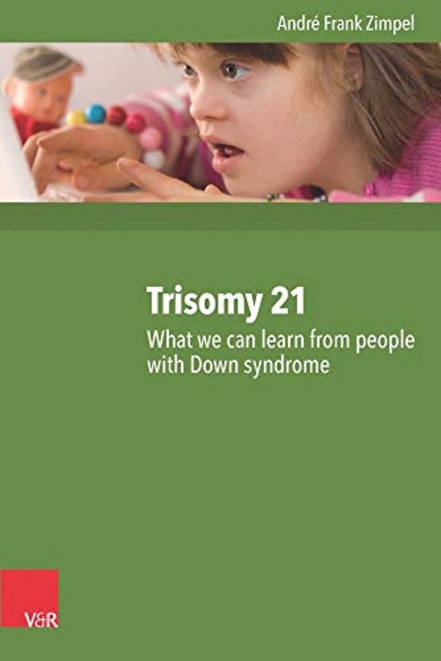 Trisomy 21