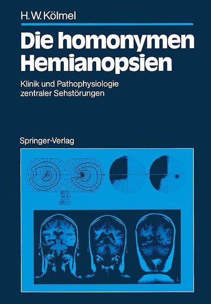 Die Homonymen Hemianopsien Door Hans W Kolmel Boek