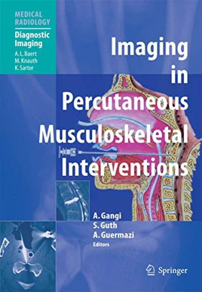 Imaging in Percutaneous Musculoskeletal Interventions