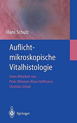 Auflichtmikroskopische Vitalhistologie