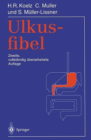 Ulkusfibel