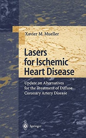 Lasers for Ischemic Heart Disease