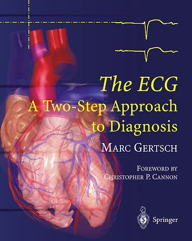 The ECG