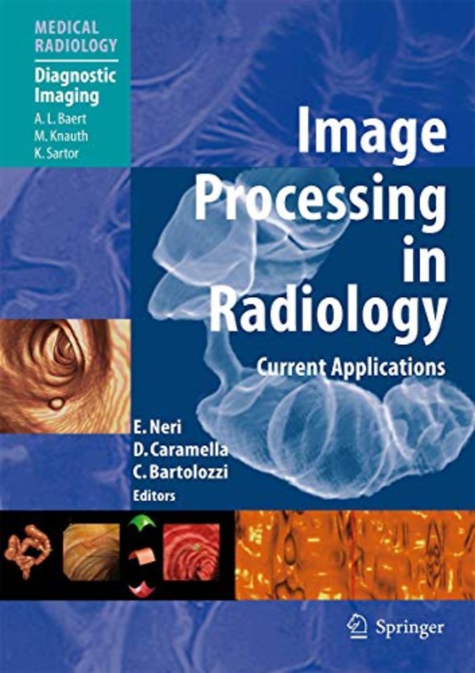 Image Processing in Radiology
