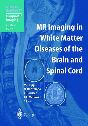 MR Imaging in White Matter Diseases of the Brain and Spinal Cord