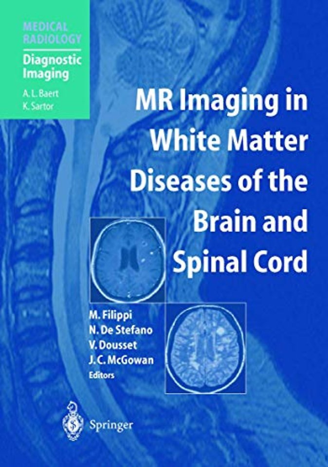 MR Imaging in White Matter Diseases of the Brain and Spinal Cord
