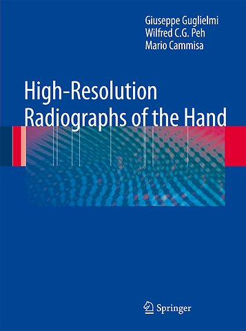 High-Resolution Radiographs of the Hand