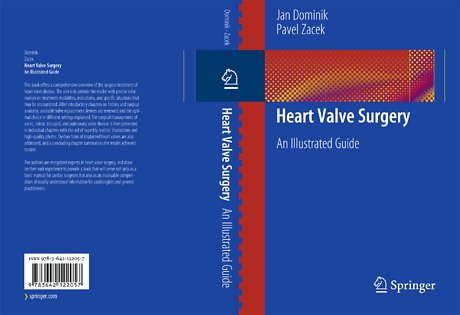 Heart Valve Surgery