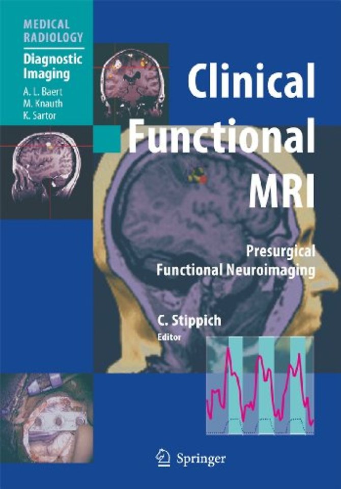 Clinical Functional MRI