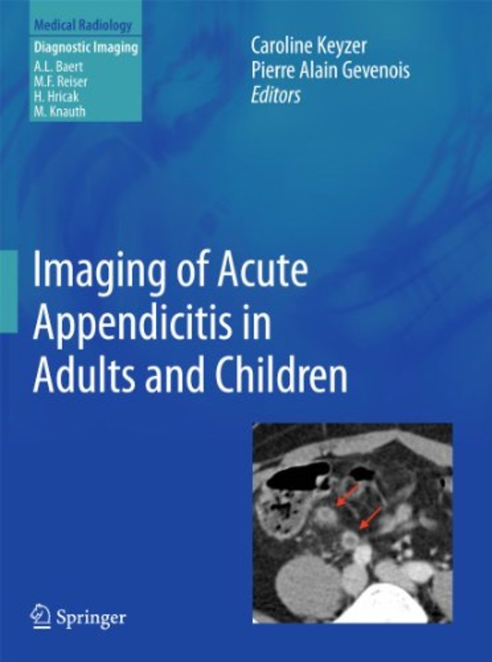 Imaging of Acute Appendicitis in Adults and Children