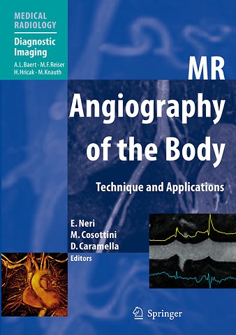 MR Angiography of the Body