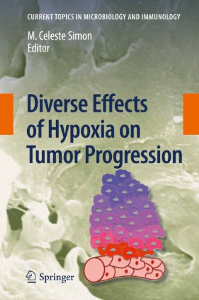 Diverse Effects of Hypoxia on Tumor Progression