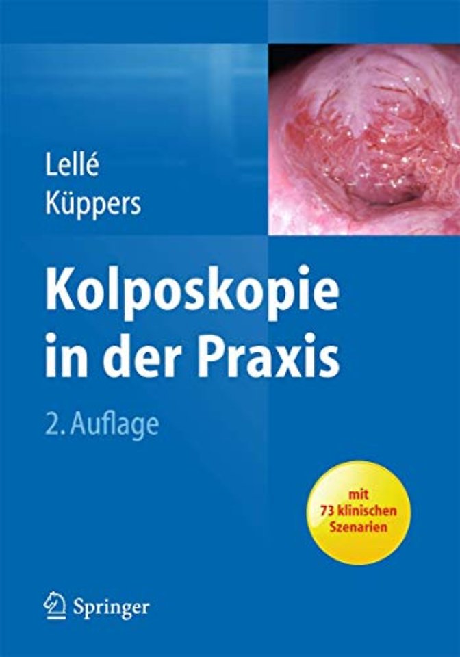 Kolposkopie in der Praxis