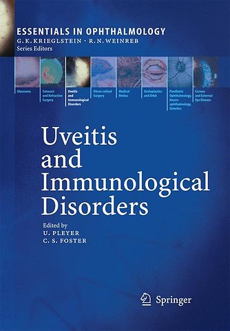 Uveitis and Immunological Disorders