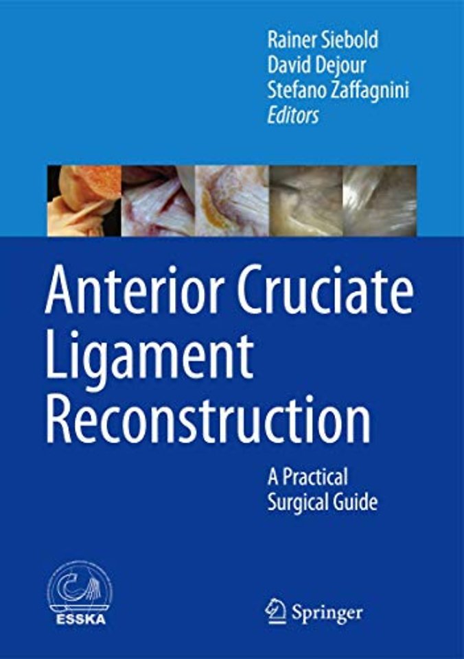 Anterior Cruciate Ligament Reconstruction