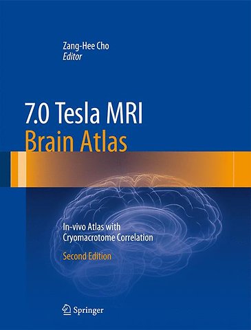 7.0 Tesla MRI Brain Atlas