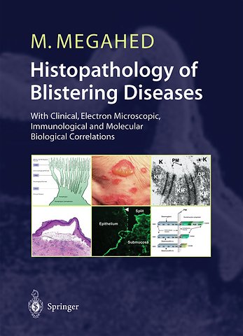 Histopathology of Blistering Diseases