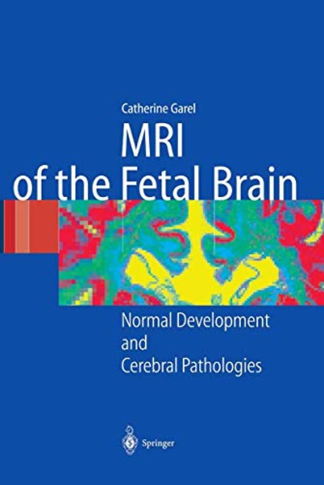 MRI of the Fetal Brain