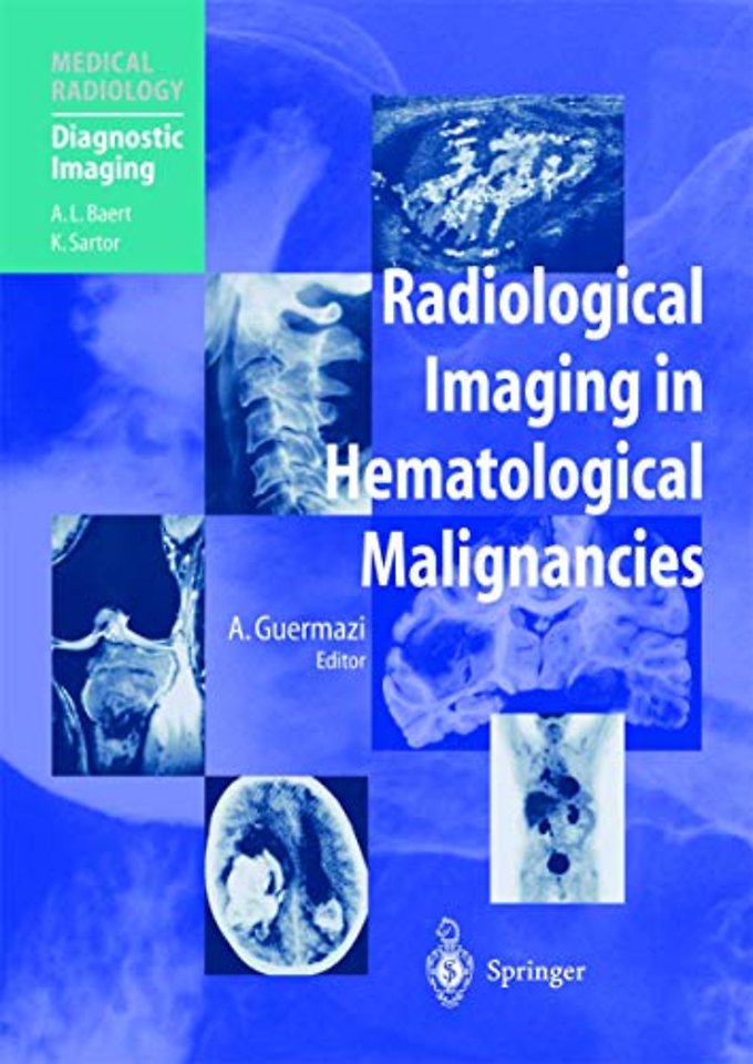 Radiological Imaging in Hematological Malignancies