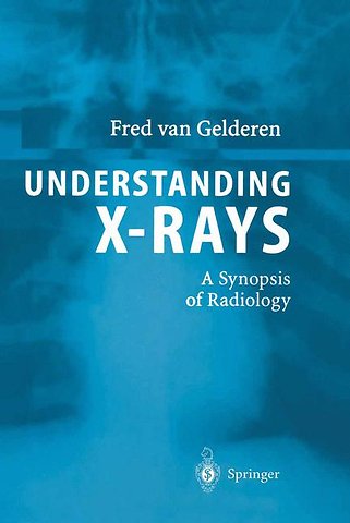 Understanding X-Rays