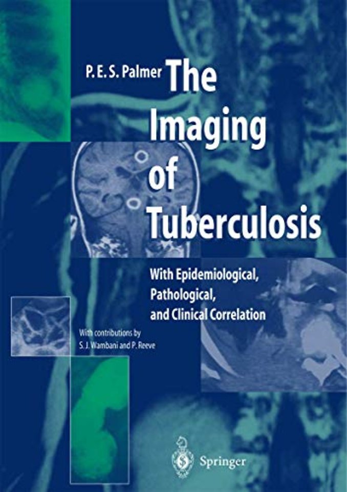 The Imaging of Tuberculosis