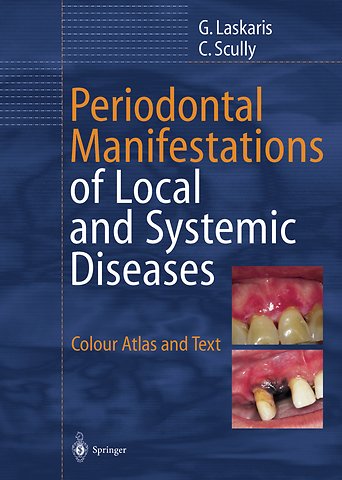 Periodontal Manifestations of Local and Systemic Diseases
