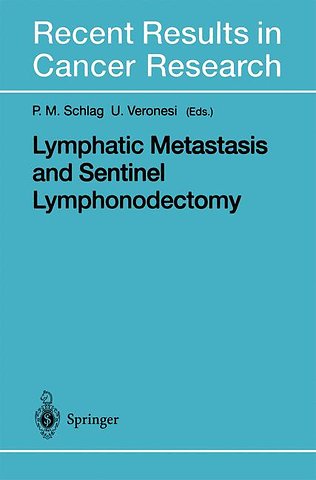 Lymphatic Metastasis and Sentinel Lymphonodectomy