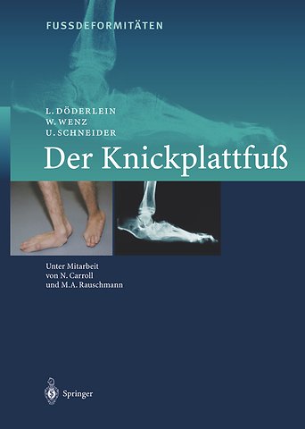 FussdeformitÄten