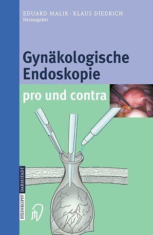 Gynäkologische Endoskopie pro und contra