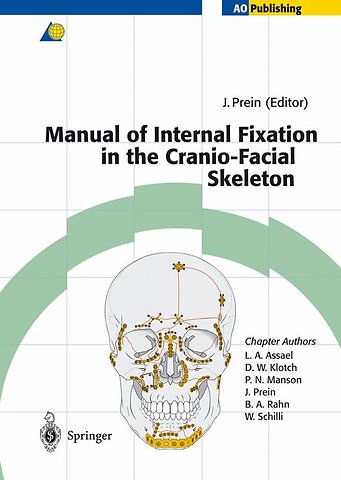 Manual of Internal Fixation in the Cranio-Facial Skeleton