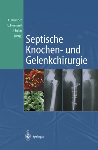Septische Knochen-und Gelenkchirurgie